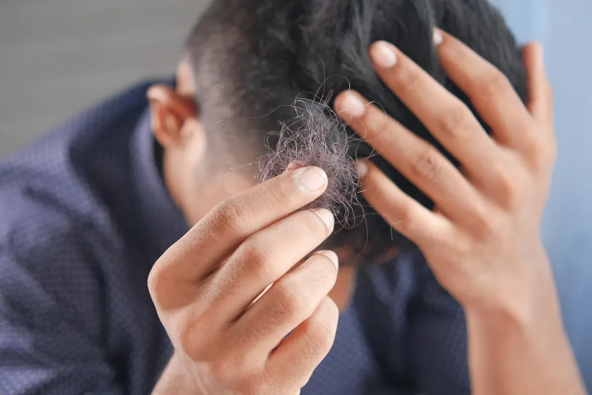 Pessoa observando os fios que ficaram na mão depois de passar pelo cabelo